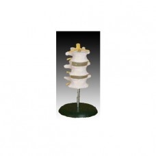 Set de 3 vertebre lombare #15071
